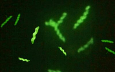 Detección y caracterización molecular de Campylobacter fetus en abortos bovinos y ovinos